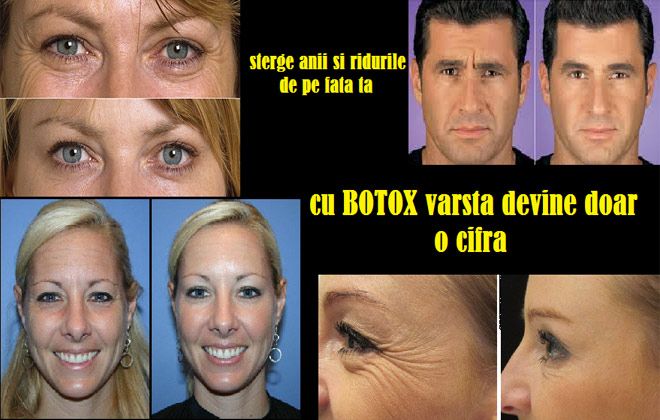 O crema poate sterge ridurile?
